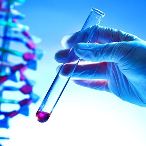 7.-In-Vitro-Diagnostics-Market-thumb 7.-In-Vitro-Diagnostics-Market-thumb